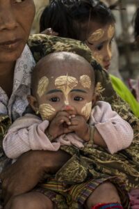 フェイスラインのニキビに効果的なヒアルロン酸クレンジングオイルの失敗しない選び方は？