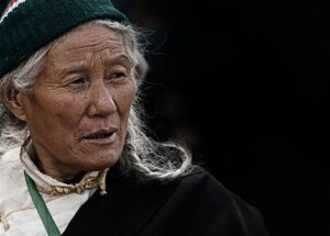 韓国皮膚科発想のニキビ肌に最適な日焼け止めは白浮きしないの？